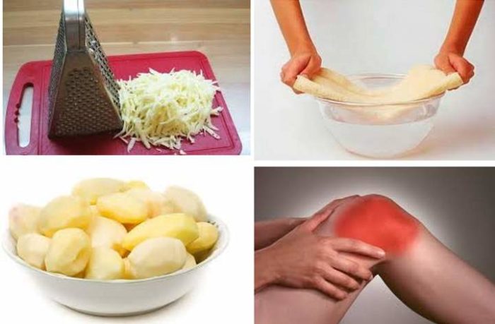 компресс из картошки в быту